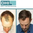 Business 8 image BEACON HAIR RESTORATION CLINIC Health & Medicine in Sandyford D