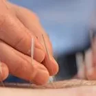 Business 5 image BLISS ACUPUNCTURE Health & Medicine in Mayo D