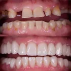 Business 1 image DENTICARE Oral & Maxillofacial Surgeons in Dublin 3 D