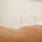 Business 3 image DUBLIN ACUPUNCTURE ROOMS Health & Medicine in Dublin IE


