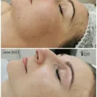 Business 6 image EVA'S BEAUTY ROOM Beauty Salons & Clinics in Galway G