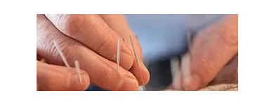 Business 5 image BLISS ACUPUNCTURE Health & Medicine in Mayo D