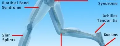 Business 6 image COMPLETE FOOTCARE CLINIC Health & Medicine in Tipperary TA