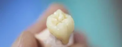 Business 9 image CROWN DENTAL DUBLIN Dentists in Dublin D