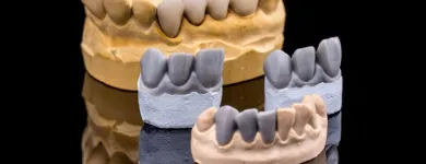 Business 7 image CROWN DENTAL DUBLIN Dentists in Dublin D