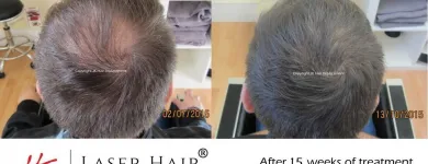 Business 8 image JK HAIR REPLACEMENT Wigs & Hairpieces in Dublin IE


